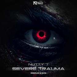 Severe Trauma