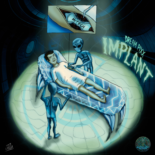 Implant